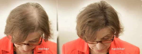 COVER HAIR Haarverdichtung Mit Schütthaar Mittelbraun 7